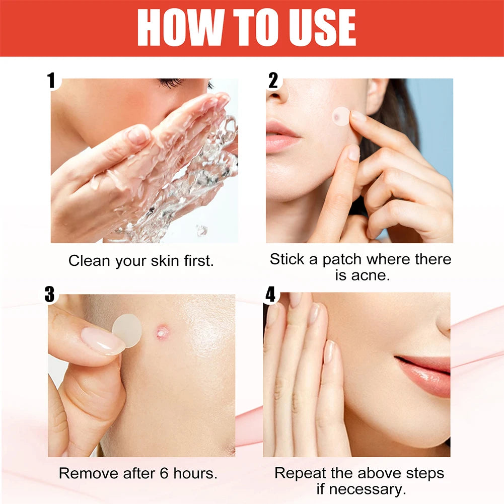 240pcs Heart/Star Pimple Patches