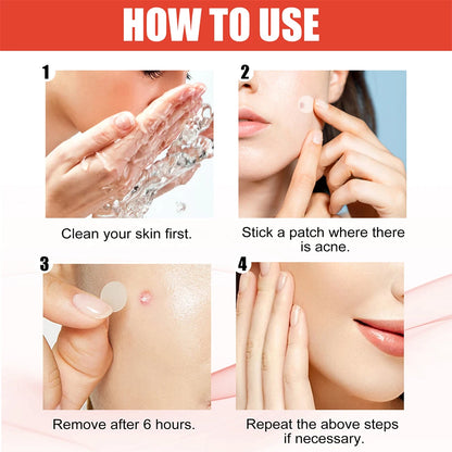 240pcs Heart/Star Pimple Patches